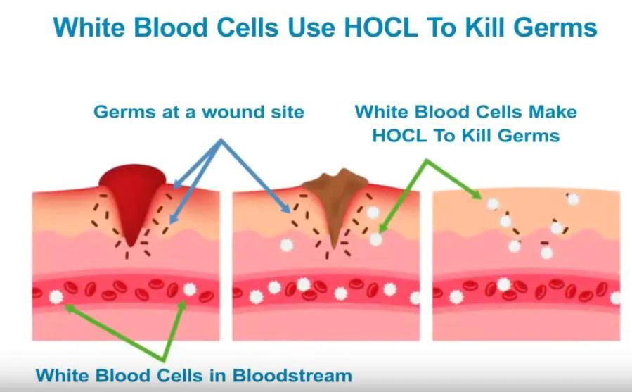 White_Blood_Cells_HOCl.webp